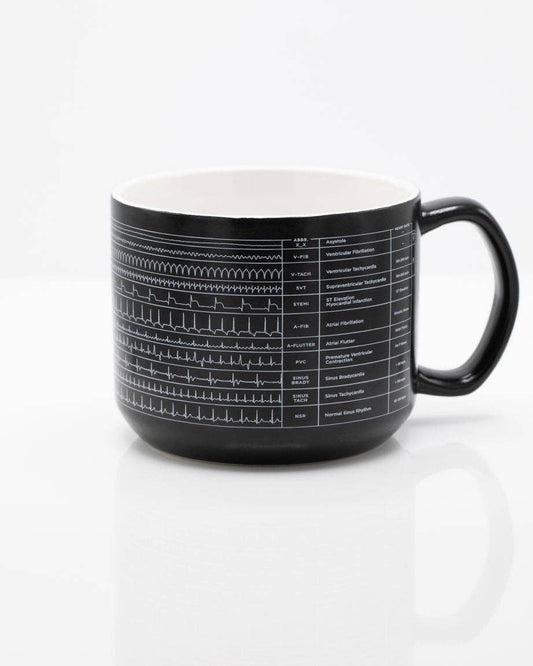 Mug Heartbeat – produit scientifique Cognitive Surplus EU, vue 1